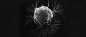 Breast cancer cell