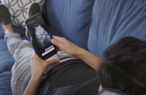 at home sonogram with a smartphone