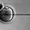 Success In Vitro Fertilization (IVF)