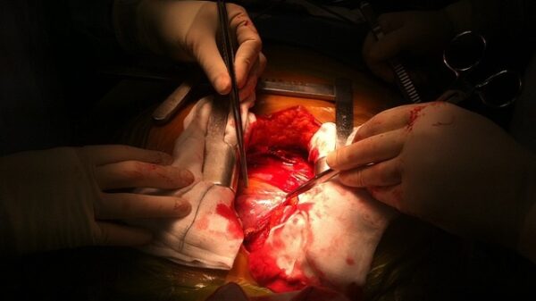 Heart Surgery Operation medicine
