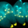 Toxoplasma gondii