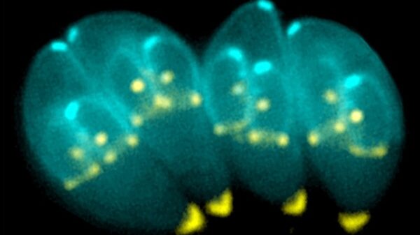 Toxoplasma gondii
